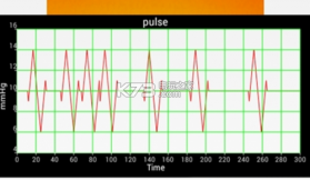 手机心电图仪 v1.1 软件下载 截图