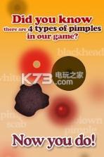 Pimple Popper v23.0 游戏下载 截图