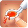 挤痘小能手 v1.0 游戏
