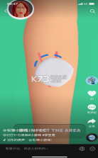 大针筒护士 v1.0.0 游戏 截图