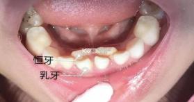 美罗精品购 v1.7.5 安卓app下载 截图